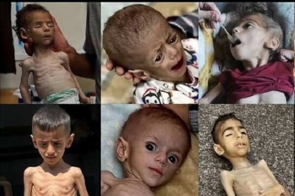 گزارش مدیر امداد پزشکی غزه از وخامت اوضاع بهداشتی