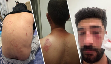کورد لە تورکیا هێشتا بەهۆی قسە کردن بە زمانی کوردی هێرشی دەکرێتە سەر