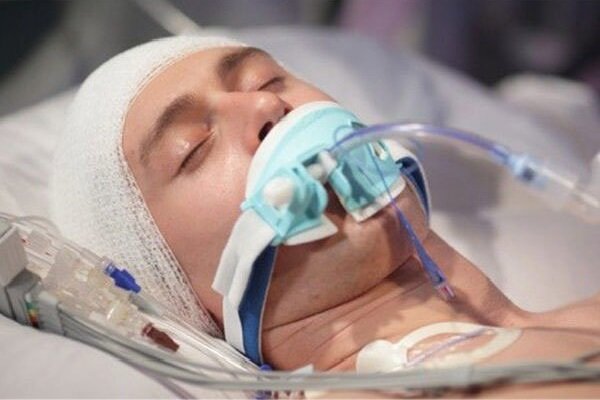 تهدید خاموش سرمایه انسانی؛ ضربه مغزی زندگی را متوقف میکند