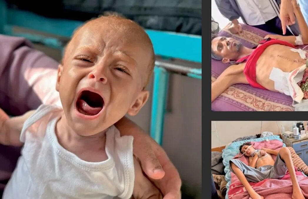 حاد،غزه،سوء،رنج،صهيونيستي