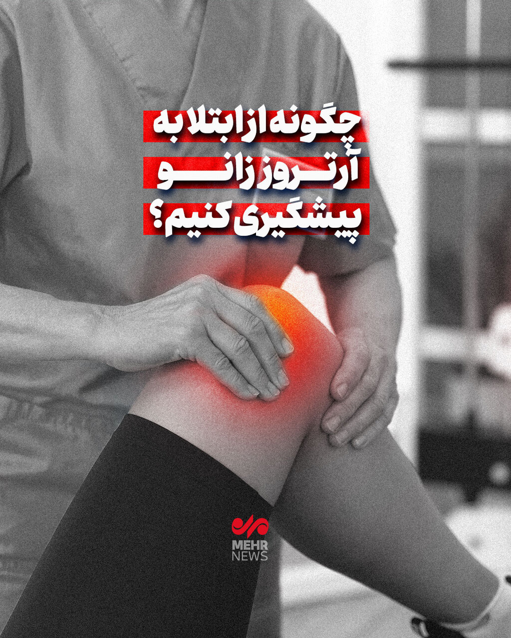 چگونه از ابتلا به آرتروز زانو پیشگیری کنیم؟