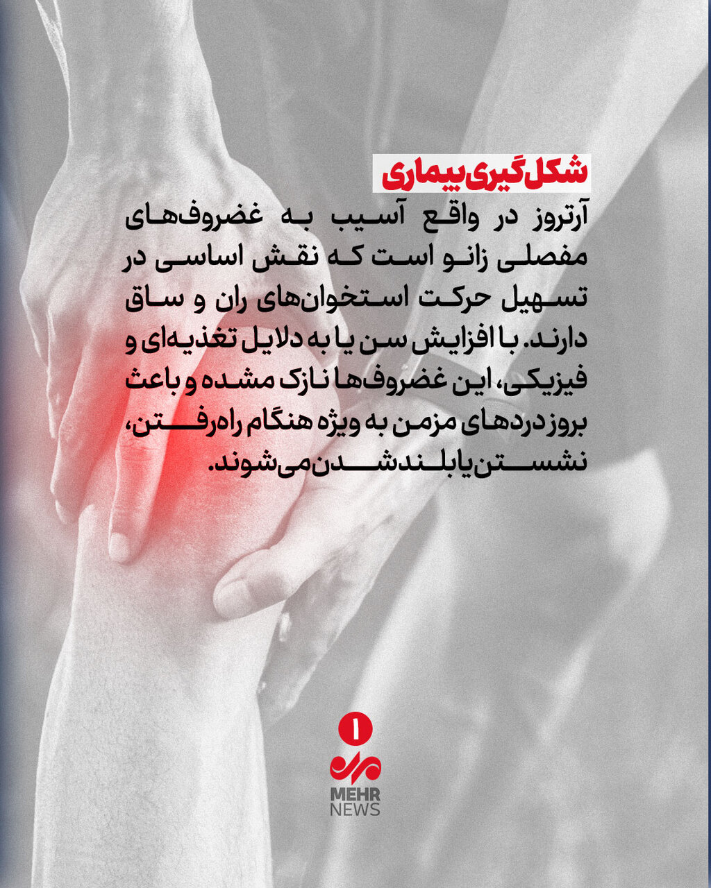 چگونه از ابتلا به آرتروز زانو پیشگیری کنیم؟
