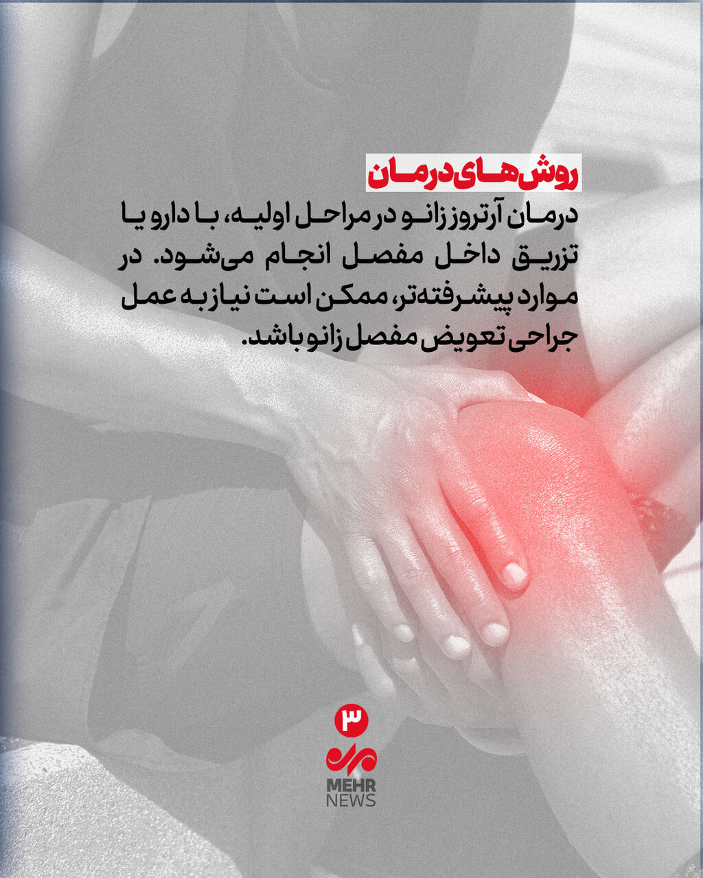 چگونه از ابتلا به آرتروز زانو پیشگیری کنیم؟