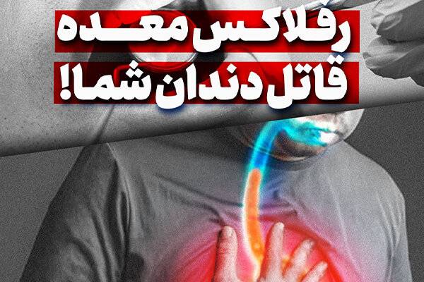 معده،رفلاكس