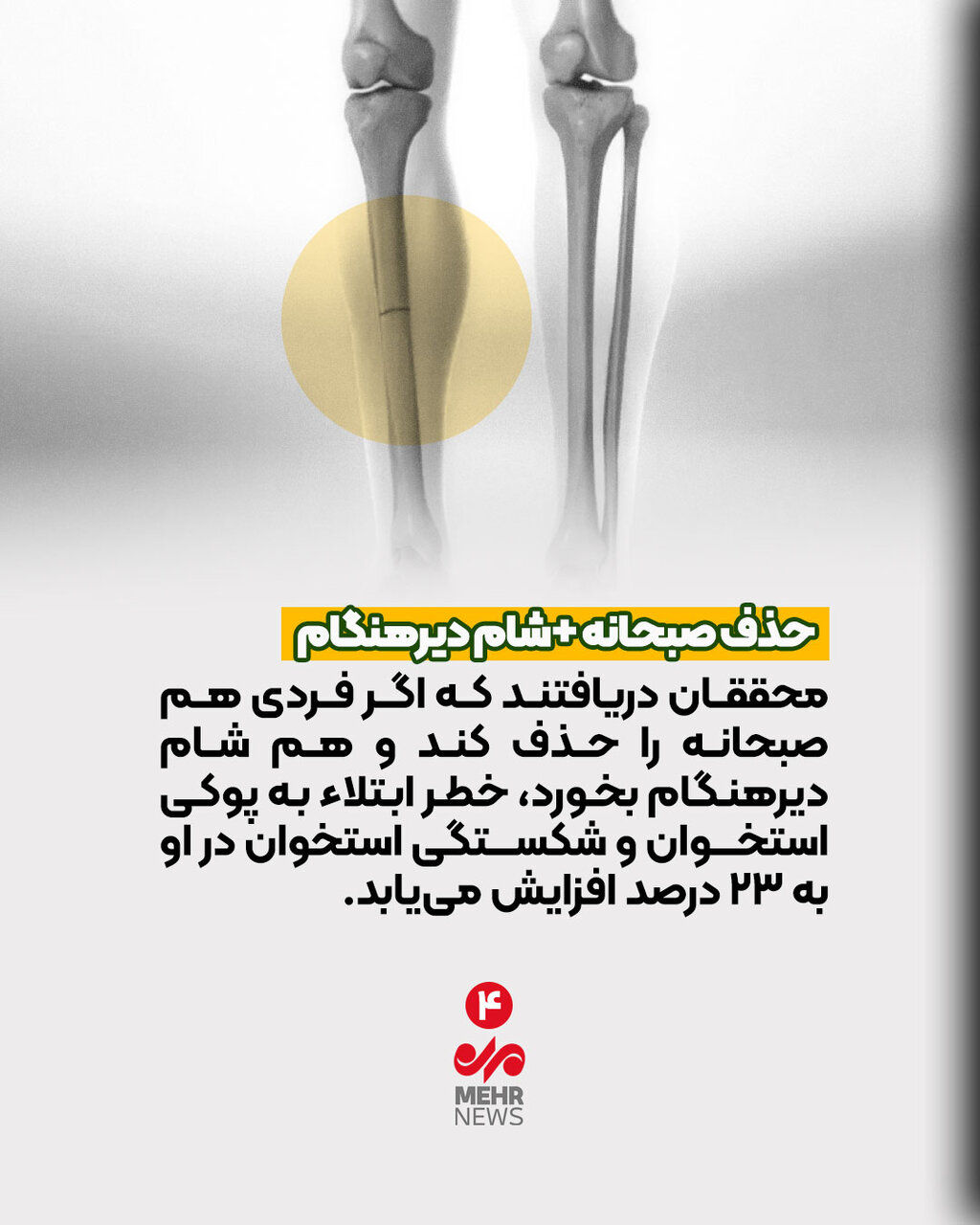صبحانه نمی خورید؛ مراقب شکستن استخوان‌هایتان باشید