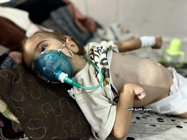 مریم ابو مصطفی؛ روایت تلخ مرگ تدریجی یک کودک در غزه+ تصاویر