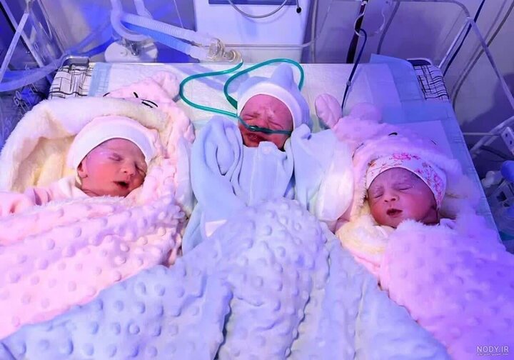 پهلوانی: سومین زایمان سهقلوی امسال در بیمارستان بهشتی کاشان ثبت شد