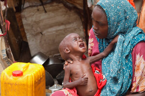 Somalia's youngest children at risk of malnutrition