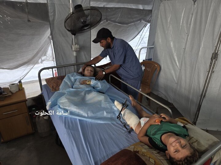 Noor; Palestinian girl who lost 3 limbs after bombing