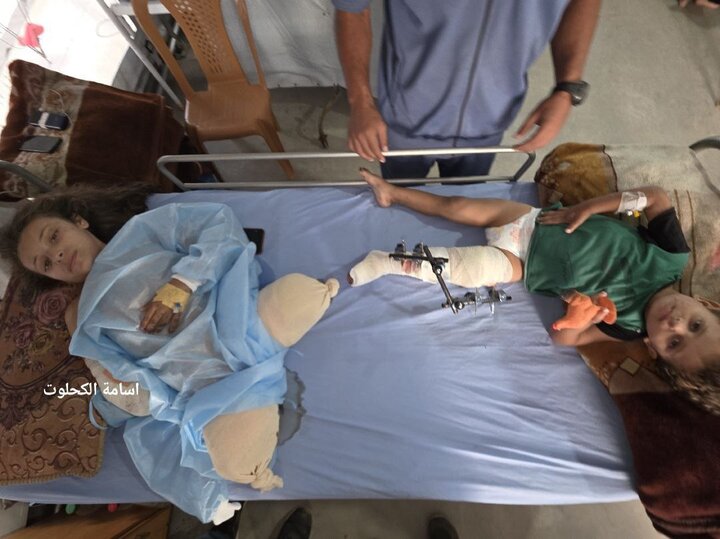 Noor; Palestinian girl who lost 3 limbs after bombing