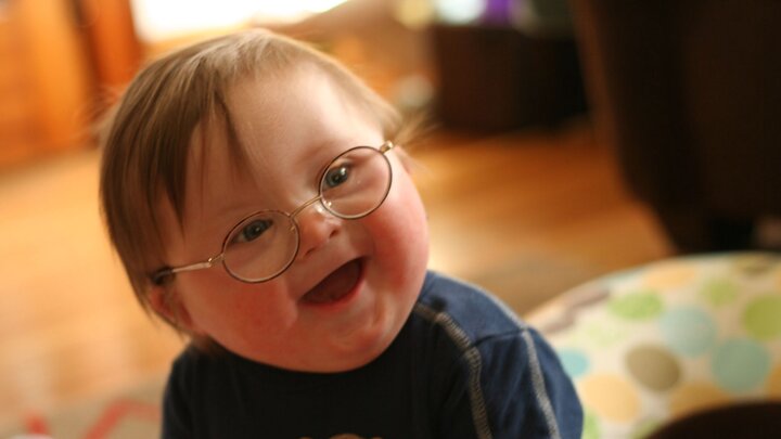 تکذیب ادعای ۲.۵ برابر شدن تولد نوزادان مبتلا به اختلالات کروموزومی تکذیب ادعای ۲.۵ برابر شدن تولد نوزادان مبتلا به اختلالات کروموزومی