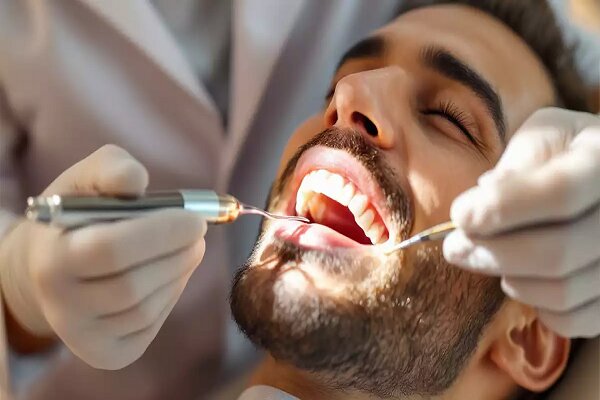 دندان،انتخاب،آمالگام،پركننده،زيبايي،كامپوزيت،استحكام،معايب،م ...