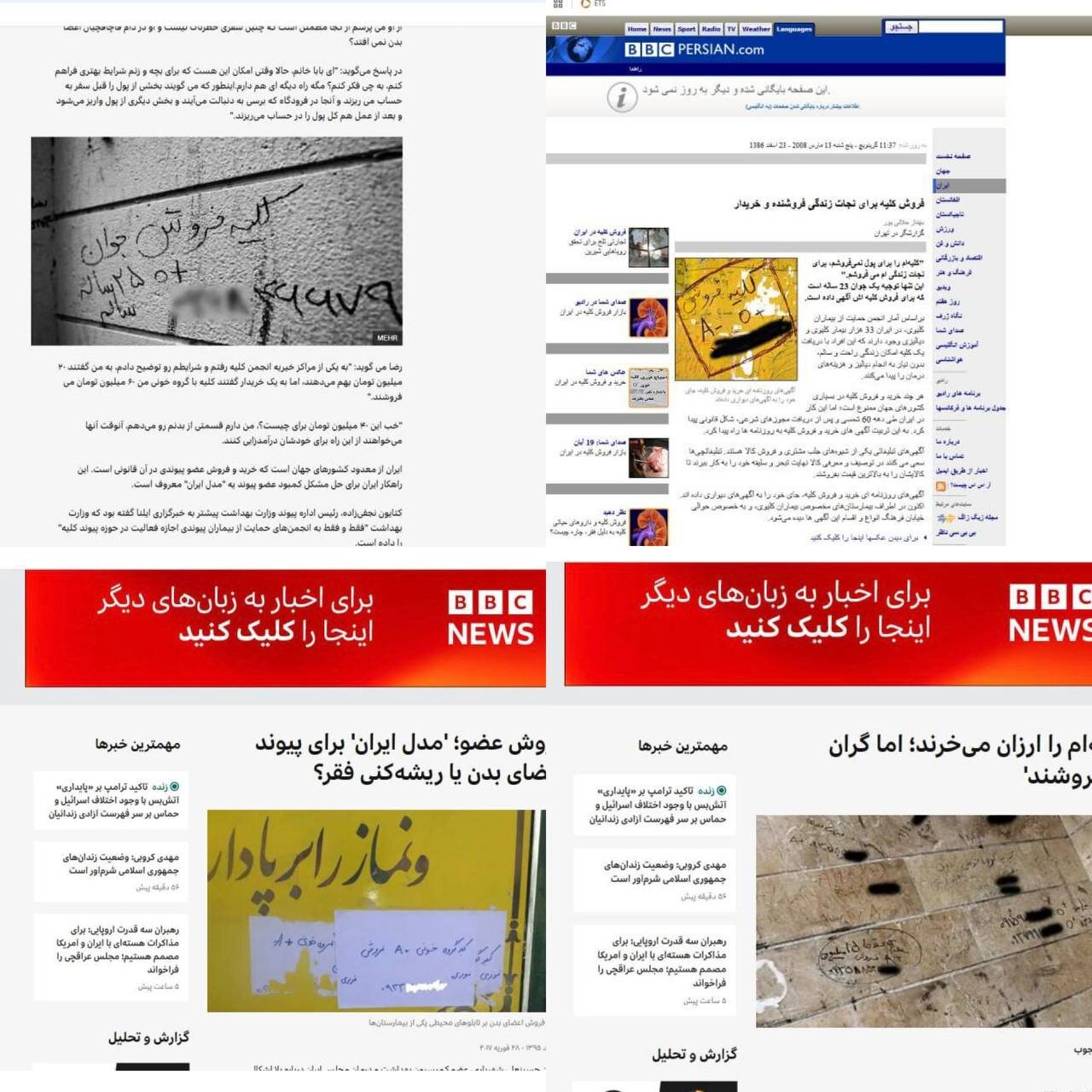 از نبود نهاد حمایتی تا موج‌سواری سودجویان؛ پشت پرده آگهی فروش کلیه