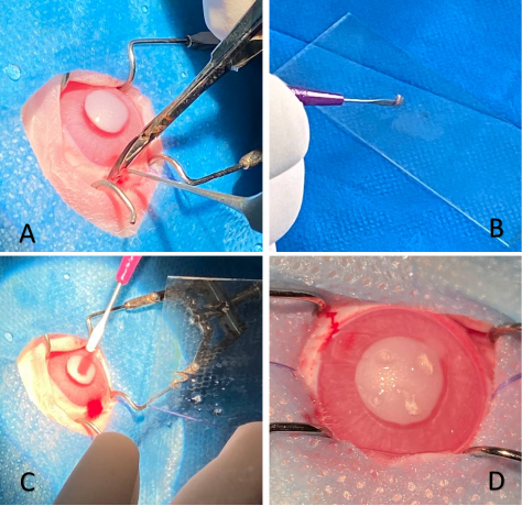 افقی تازه در درمان زخم‌های شدید قرنیه با استفاده از سلول‌های بنیادی