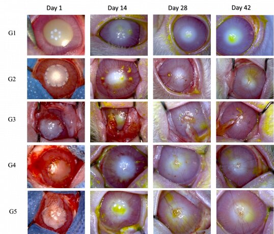 افقی تازه در درمان زخمهای شدید قرنیه با استفاده از سلولهای بنیادی