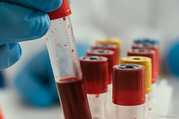 تولید آلبومین در پالایشگاه خون؛ صادرات کیت‌های تشخیصی به ۳ کشور