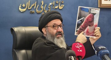 حدود ۱۲۵۰ بیمار ای بی در کشور شناسایی شده اند