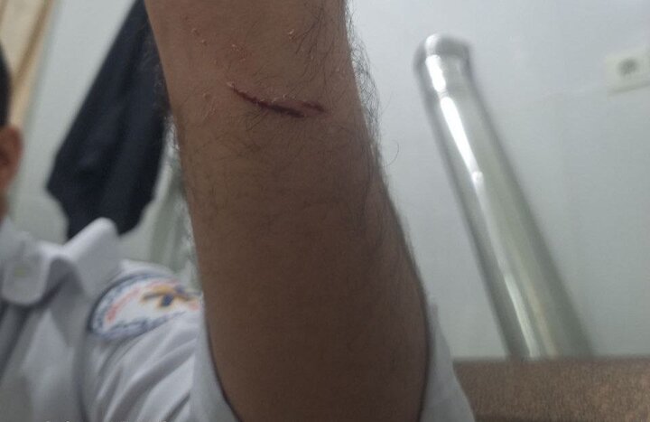 حمله به امدادگر اورژانس ۱۱۵ در کردستان توسط فرد بیمارنما حمله به امدادگر اورژانس ۱۱۵ در کردستان توسط فرد بیمارنما