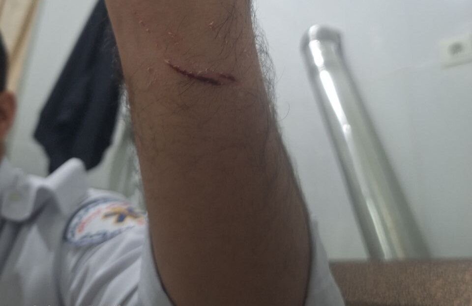 حمله به امدادگر اورژانس ۱۱۵ در کردستان توسط فرد بیمارنما حمله به امدادگر اورژانس ۱۱۵ در کردستان توسط فرد بیمارنما