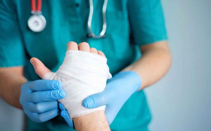 سوختگی؛ آسیب جسمی و روانی که فراتر از درمان است سوختگی؛ آسیب جسمی و روانی که فراتر از درمان است