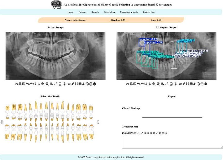 توسعه سامانه هوش مصنوعی تشخیص بیماریهای دندان در دانشگاه تهران