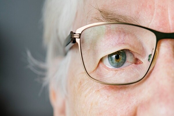 پیرچشمی چیست و چه زمانی بروز میکند؟ پیرچشمی چیست و چه زمانی بروز میکند؟