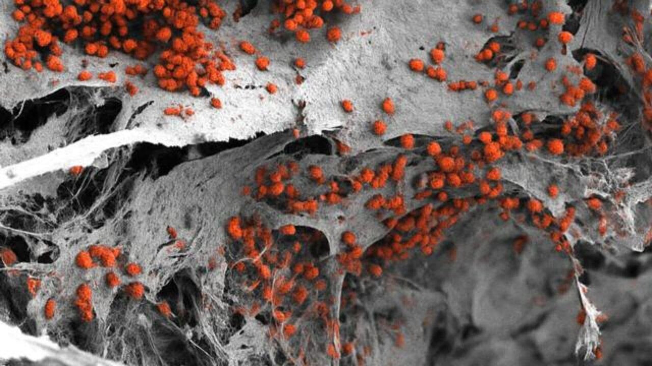 استخوان،مغز،خون،انسان،خوني،مصنوعي،بنيادي،مخصوص،مرحله،داربست، ...