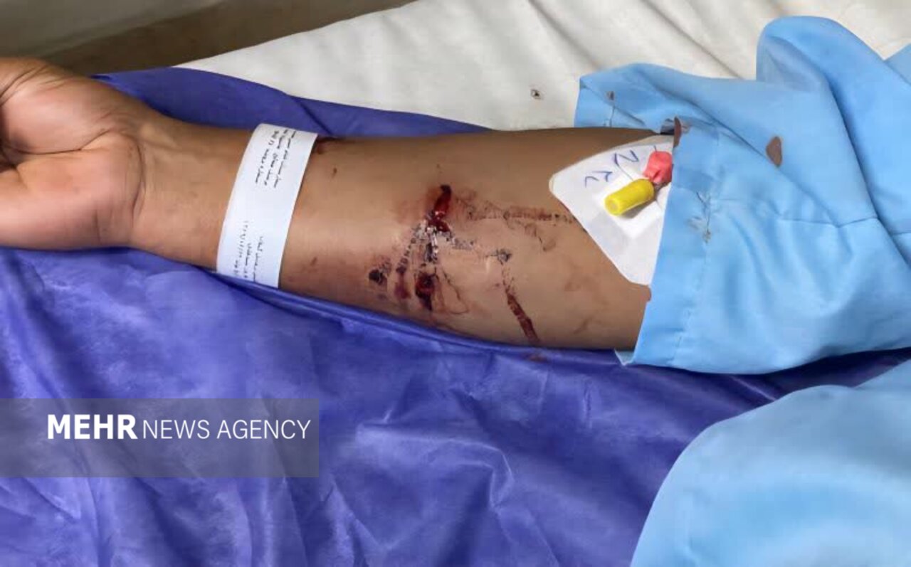 دادستان فومن: برخی گروهها مانع ساماندهی سگ های ولگرد میشوند دادستان فومن: برخی گروهها مانع ساماندهی سگ های ولگرد میشوند