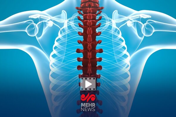 فيزيوتراپي