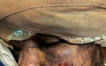 رد خون تروریسم روی «سلامت»؛ هدف از حمله به آمبولانس‌ها چیست؟