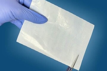 درمان زخم با زخم‌پوش فوق‌نازک هوشمند و صرفه‌جویی یک میلیون دلاری