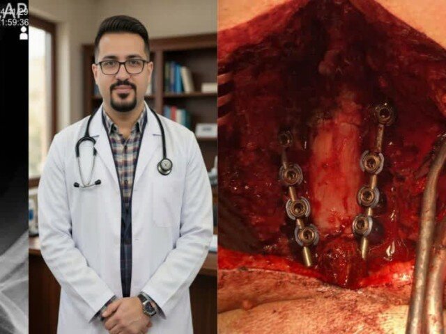 جراحي،بيمار،مهره،اعصاب،مغز،درمان،محمدي،درماني،بيمارستان،آسيب ...