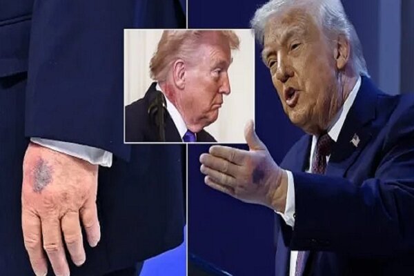 پزشكي،معاينه،كاخ،سفيد،بيمارستان،ريد،والتر،اطلاعاتي،توانايي