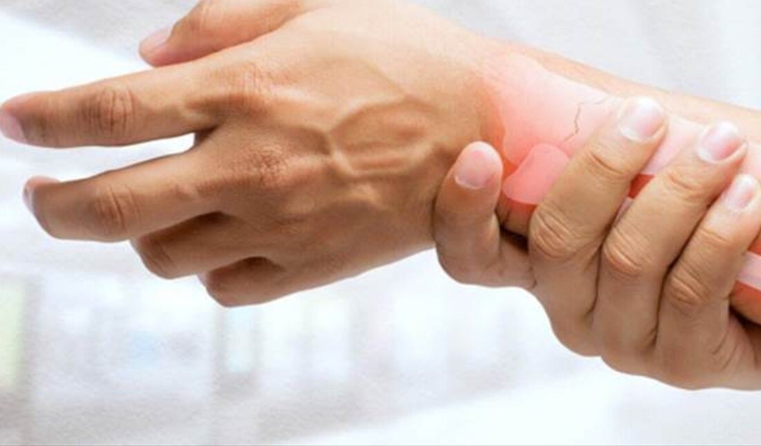 متوتروكسات،درمان،آرتريت،روماتوئيد،كاهش،بيماري،افزايش،اثربخشي ...