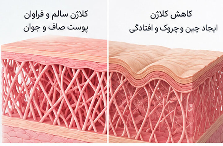 پزشکان هشدار می‌دهند؛ کمبود این ماده غذایی، پوست را زودتر پیر می‌کند