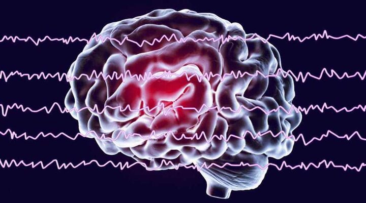 Iran develops smart device to measure depth of anesthesia