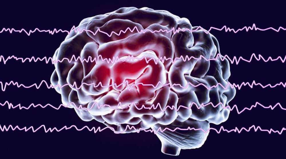 Iran develops smart device to measure depth of anesthesia