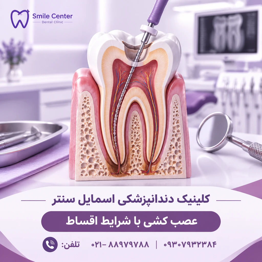 کلینیک دندانپزشکی اسمایل سنتر؛ ایمپلنت اقساطی و عصبکشی در تهران