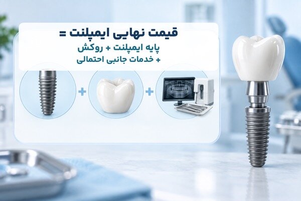 چرا هزینه نهایی ایمپلنت با قیمت اولیه تفاوت دارد؟
