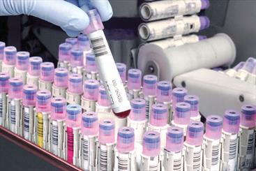 ذخیره‌سازی ۸۰۰ نمونه در بانک خون بند ناف رویان اردبیل