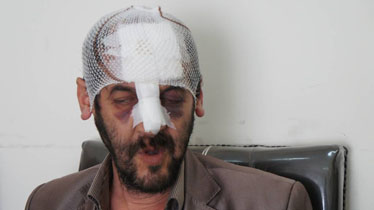 حادثه بر اثر عدم مناسب‌سازی خیابان/ مجروحیت روشندل نوشهری هم مسئولان را بینا نکرد