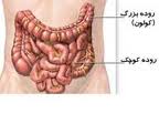 روند افزایش سرطان روده بزرگ در گیلان رو به رشد است/40 درصد جمعیت استان مبتلا به کبد چرب